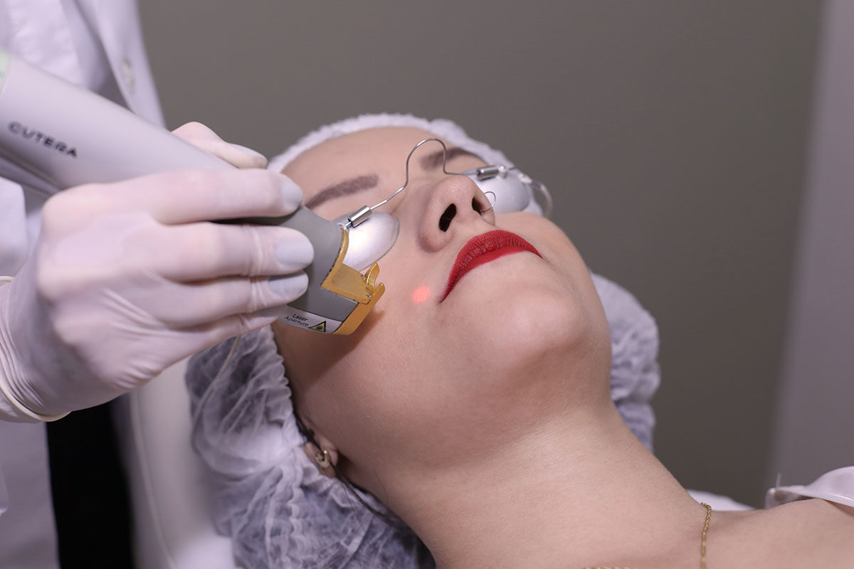 Tratamentos contra o Melasma