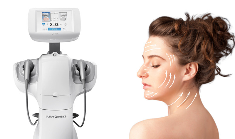 Conheça o Ultraformer III, tecnologia para tratamentos faciais e corporais
